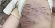Bé trai 2 tuổi bị mẹ ruột và tình nhân bạo hành, hôn mê sâu