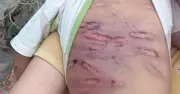 Bé trai 2 tuổi bị mẹ và người tình đánh hôn mê, gãy xương