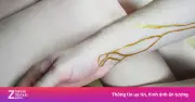 Bé trai Hà Tĩnh mang nhóm máu cực hiếm Jk(a-b-3) được cứu sống nhờ truyền máu mẹ