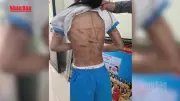 Bộ Y tế đề nghị lập đường dây nóng 24/7 xử nghiêm che giấu bạo hành trẻ em