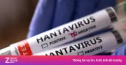 Bộ Y tế thông tin chùm ca virus Hanta trên tàu MV Hondius, khuyến cáo phòng bệnh
