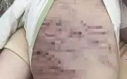 Bộ Y tế yêu cầu bảo vệ bé 2 tuổi bị bạo hành đa chấn thương tại TP.HCM