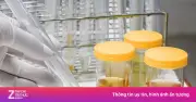Bác sĩ cảnh báo 3 sai lầm âm thầm hủy hoại thận nhiều người mắc phải