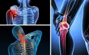 Bác sĩ cảnh báo 6 dấu hiệu ung thư xương giai đoạn đầu dễ nhầm với thiếu canxi
