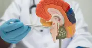 Bác sĩ thần kinh tiết lộ ba thói quen hàng ngày có thể gây đột quỵ