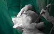 Bụng to như mang bầu 9 tháng vì khối u tái phát nặng 5kg