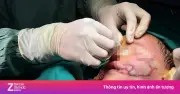 Bệnh dại diễn tiến lặng lẽ, khó cứu khi đã phát bệnh