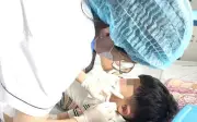 Bệnh viện Bệnh nhiệt đới Trung ương phẫu thuật thành công rò luân nhĩ cho bé trai 6 tuổi