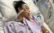 Bật điều hòa 6 tháng không vệ sinh, người đàn ông 32 tuổi nhập viện vì viêm phổi nặng