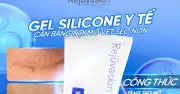 Chuyên gia hướng dẫn cách dùng kem làm mờ sẹo lồi chuẩn y khoa, hiệu quả sau 4 tuần