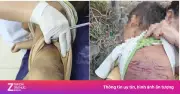 Công an TP.HCM truy tìm thân nhân bé 2 tuổi bị mẹ và người tình bạo hành