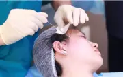 Cảnh báo trào lưu tự nâng cơ bằng chỉ tại nhà trên TikTok