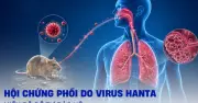 Cảnh báo virus Hanta: Nguy cơ lây nhiễm tại Việt Nam và cách phòng tránh
