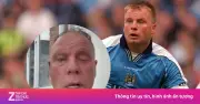 Cựu đội trưởng Man City Morrison mắc hội chứng Ramsay Hunt, gương mặt biến dạng