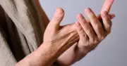 Dấu hiệu bệnh gan qua móng tay: 4 thay đổi cần chú ý