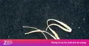 Dấu hiệu nhiễm ký sinh trùng nguy hiểm giai đoạn đầu dễ bỏ qua