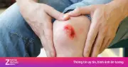 Dấu hiệu nhận biết cơ thể thiếu kẽm và cách khắc phục