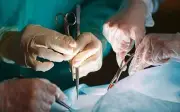 Giẫm phải thức ăn cho chó, người phụ nữ bị cắt cụt chân vì nhiễm trùng