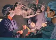 Kỹ thuật mới điều trị động kinh dưới hướng dẫn của điện não đồ vỏ não