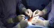 Kỹ thuật vi phẫu tạo hình lưỡi sau phẫu thuật ung thư tại Bệnh viện K