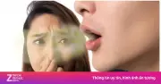 Lý do bạn chăm chỉ đánh răng vẫn hôi miệng? Nguyên nhân và cách khắc phục