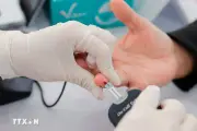 Lâm Đồng tạm dừng khám sức khỏe miễn phí, chuẩn bị các điều kiện cần thiết