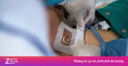 Loạt thói quen đẩy người trẻ đến đột quỵ xuất huyết não