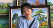 Lupus ban đỏ hệ thống: Bệnh tự miễn nguy hiểm thường gặp ở nữ giới