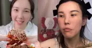 Mặt cô gái trẻ biến dạng sau 2 năm làm mukbang, bác sĩ cảnh báo 4 cái giá sức khỏe ít ai biết