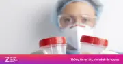 Nước tiểu nhiều bọt có phải suy thận? Bác sĩ giải đáp