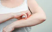 Ngứa da kéo dài cảnh báo ung thư: Dấu hiệu không thể bỏ qua