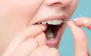 Người đeo chỉ nha khoa cần lưu ý điều này để tránh hại răng
