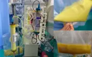 Người đàn ông 25 tuổi nhập viện vì máu nhiễm mỡ, thói quen ăn uống thiếu kiểm soát