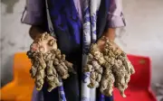 Người đàn ông Bangladesh mắc bệnh 'người cây' khao khát cuộc sống bình thường