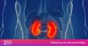 Người đàn ông suy thận vì ăn hải sản 30 năm: Cảnh báo kim loại nặng