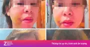 Người phụ nữ ở Đắk Lắk cầu cứu vì bị chồng bạo hành nhiều lần