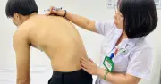 Ngày càng nhiều người trẻ mắc viêm cột sống dính khớp, dễ bỏ qua dấu hiệu