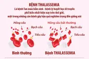 Ngày Thalassemia Thế giới: 85% người Việt mang gen bệnh không biết