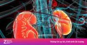 Những nguyên nhân hàng đầu dẫn đến suy thận mạn tính