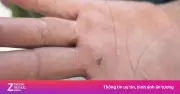 Nắng nóng gay gắt, số ca tiêm phòng dại tăng vọt: Cảnh báo nguy cơ tử vong