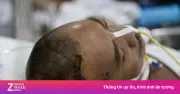 Phía sau những chiếc giường 'chưa biết ngày tỉnh' ở Bệnh viện Chợ Rẫy