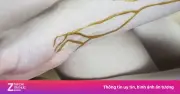 Phát hiện nhóm máu B(A) siêu hiếm, chỉ 3 người trên thế giới sở hữu