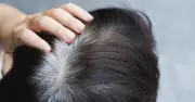 Tóc bạc sớm: Nguyên nhân từ thiếu dinh dưỡng và cách khắc phục