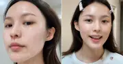 Top 3 kem dưỡng chống lão hóa đỉnh cao: Frezyderm, Sakura, VI Derm