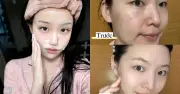 Top 6 sữa rửa mặt cho da dầu mụn: Làm sạch sâu, ngừa mụn hiệu quả