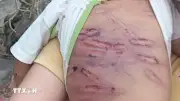 TP.HCM khẩn trương cấp đổi bảo hành cho cháu bé 2 tuổi