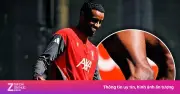Đầu gối biến dạng của Isak gây lo ngại về thể lực tại Liverpool