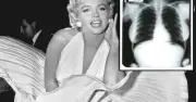 Đấu giá phim X-quang của Marilyn Monroe gây tranh cãi