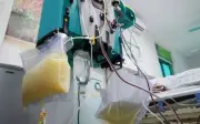 Uống 3 cốc trà sữa mỗi ngày, cô gái 27 tuổi bị viêm tụy cấp nguy kịch