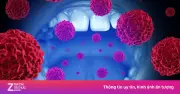Ung thư miệng gia tăng ở người trẻ: Thói quen tưởng vô hại hóa 'thủ phạm'